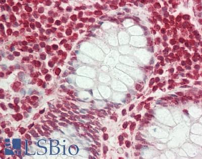 RTCB / C22orf28 Antibody (aa107-156)