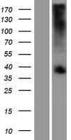 TAS2R39 Protein (Over-Expression Lysate Myc-DDK (Flag))