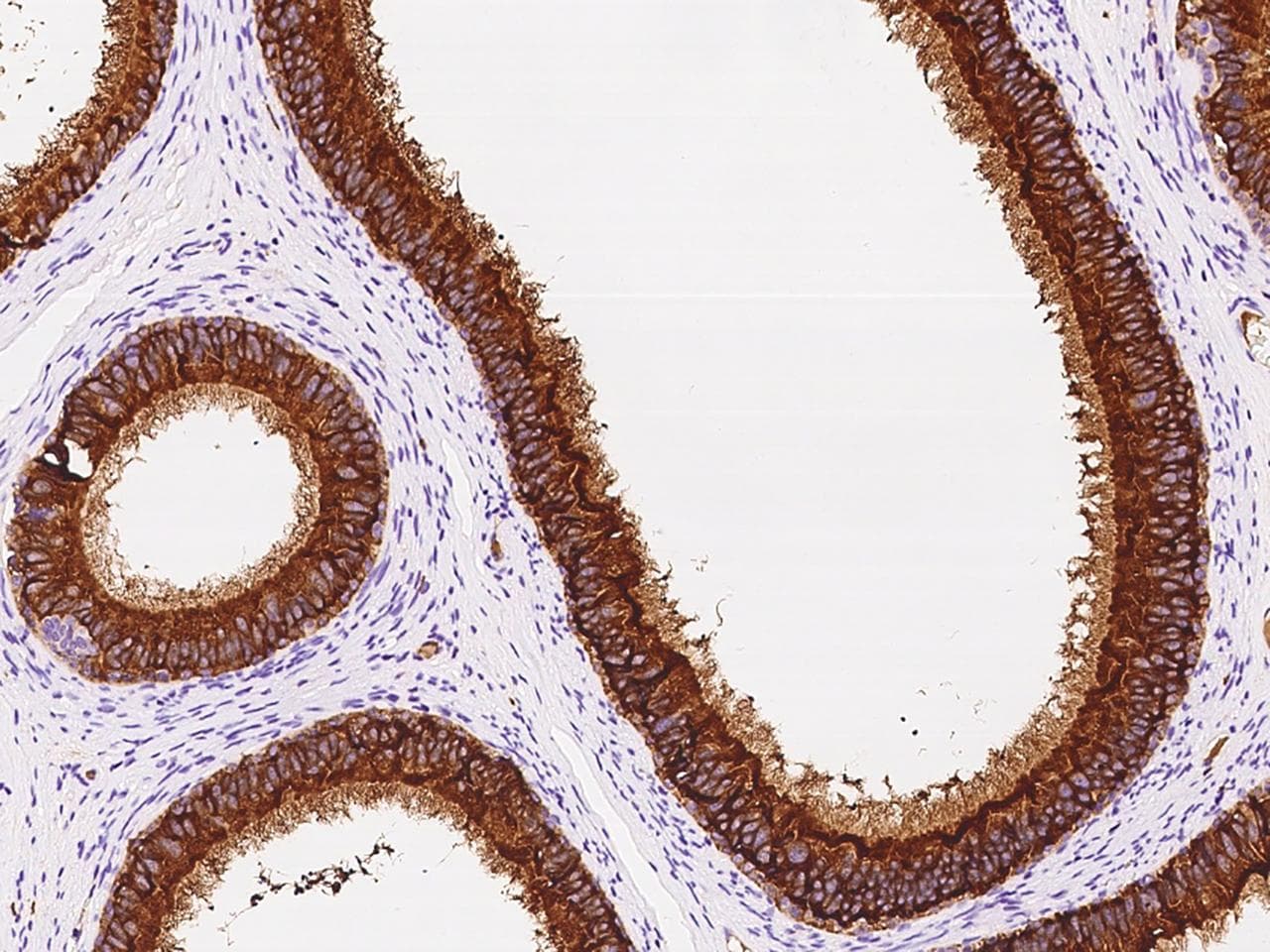 DEFB118 Antibody