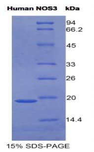 Human NOS3 / eNOS Protein (Recombinant His)