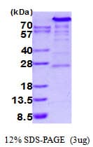 Human HK2 / Hexokinase 2 Protein (Recombinant His)