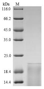 Rat TSHB / TSH-Beta Protein (Recombinant 6His, N-terminus + Myc, C-terminus)