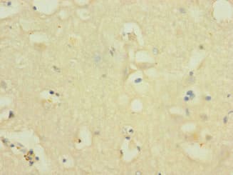 Polyclonal Rabbit anti-Human NOX3 Antibody (IHC, WB)
