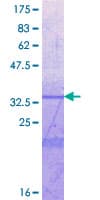 Human ICAM5 / ICAM-5 Protein (Recombinant GST, N-terminus)