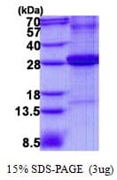 Human CFD / Factor D / Adipsin Protein (Recombinant His)