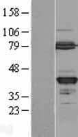 GMPR2 Protein (Over-Expression Lysate Myc-DDK (Flag))