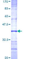 Human NAGLU Protein (Recombinant GST, N-terminus)