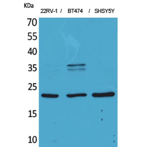 FGF12 Antibody (Internal)