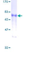 Human DOK2 Protein (Recombinant GST)