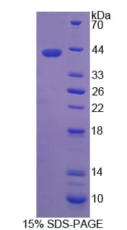 Human RLBP1 / CRALBP Protein (Recombinant His-T7)