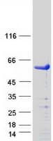 Human SMAD3 Protein (Recombinant Myc-DDK (Flag))