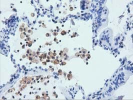 Monoclonal Mouse anti-Human ARHGAP25 Antibody (clone OTI11B9, IHC, IF, WB)