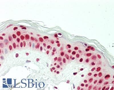 IHC-plus™ CCAR2 / KIAA1967 Antibody (aa875-C-term)