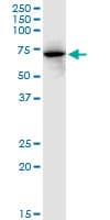 FKBP10 / FKBP65 Antibody (clone 2D4)
