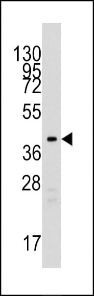 TBRG1 Antibody (aa6-36)