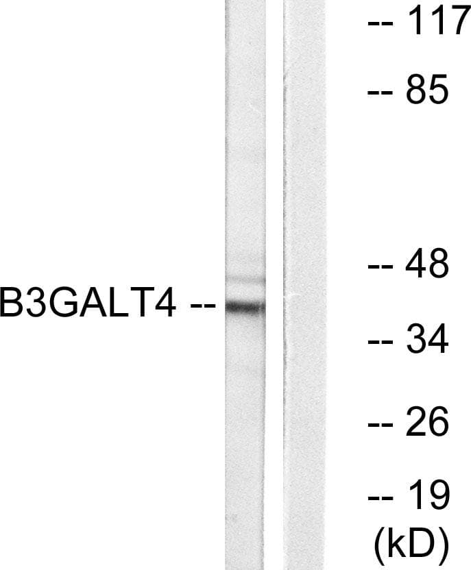 GALT4 / B3GALT4 Antibody