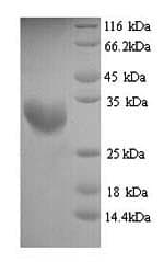 Human PNMA2 / MA2 Protein (Recombinant 6His, N-terminus)