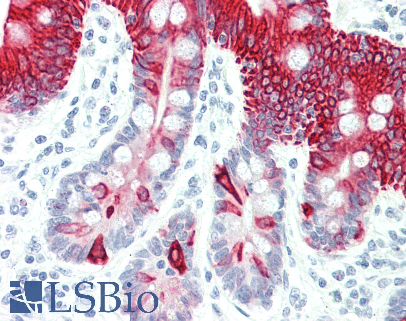 PathPlus™ Polyclonal Rabbit anti-Human KRT20 / CK20 / Cytokeratin 20 Antibody (clone E19-I, IHC)