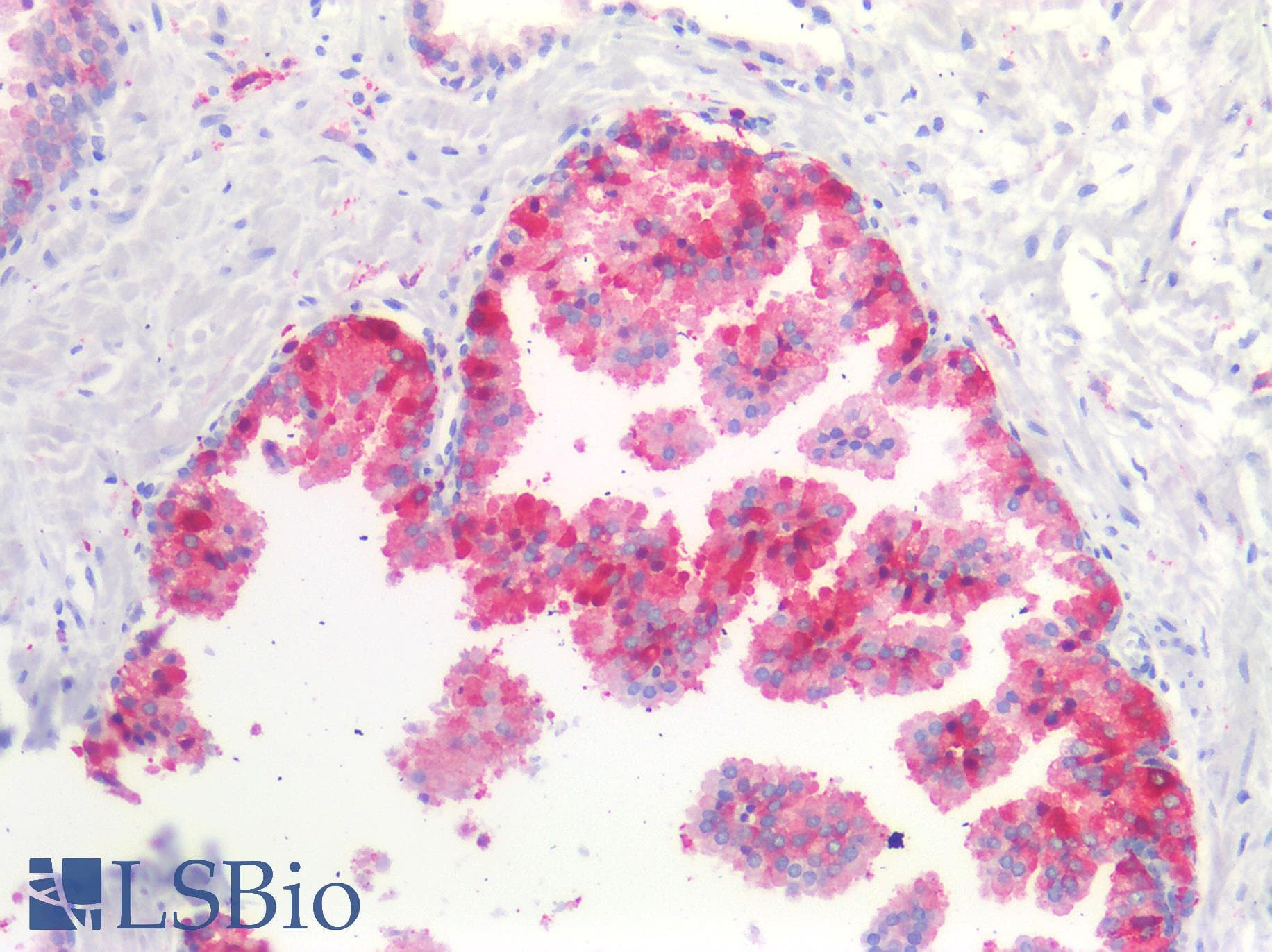 IHC-plus™ Polyclonal Rabbit anti-Human NEFH / NF-H Antibody (IHC)