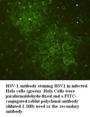 Polyclonal Rabbit anti-Herpes Simplex Virus HSV-1 / Herpes Simplex Virus 1 Antibody (IF)