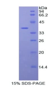 Human FBLN4 / EFEMP2 Protein (Recombinant His-GST)