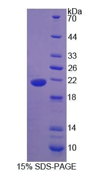 Human IHH Protein (Recombinant His, N-Terminal)