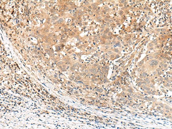 KCNA10 Antibody