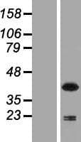 Human P40PHOX / NCF4 Protein (Over-Expression Lysate Myc-DDK (Flag))