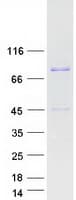 Human EEF1D Protein (Recombinant Myc-DDK (Flag))