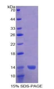 Human ADAMTS1 Protein (Recombinant His)