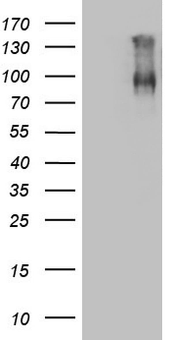 F13B / TGase Antibody (aa357-661, clone OTI2H10)