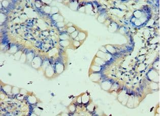 Polyclonal Rabbit anti-Human C3AR / C3a Receptor Antibody (aa160-340, IHC)