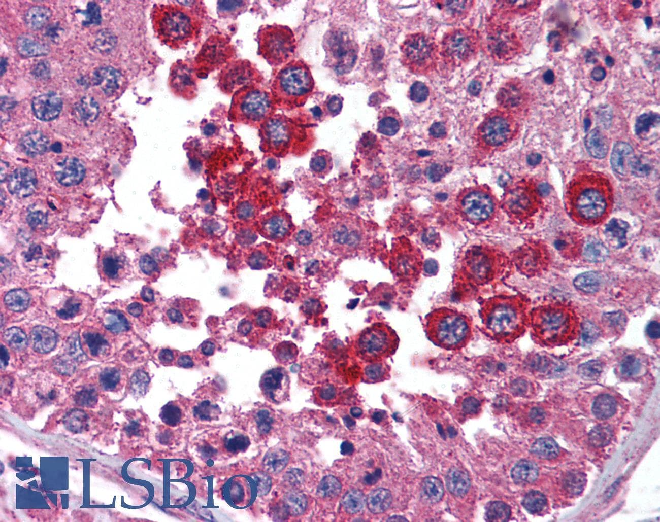 IHC-plus™ STAT4 Antibody (N-Terminus)