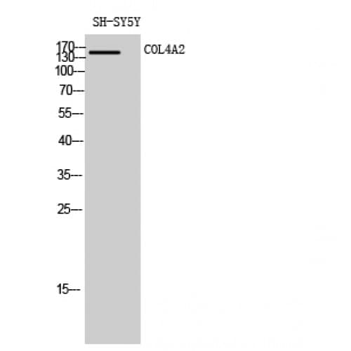 COL4A2 / Collagen IV Alpha2 Antibody (120-200 aa, N-terminal)