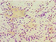 TGM2 / Transglutaminase 2 Antibody (aa438-687)