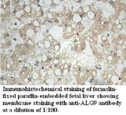 ALG9 Antibody (aa435-618)