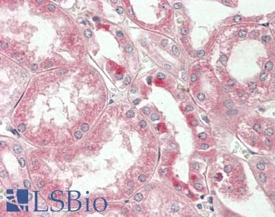 IHC-plus™ LONP2 / LONP Antibody (aa104-132)