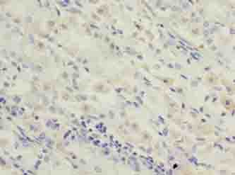 Polyclonal Rabbit anti-Human OXSM / KS Antibody (IHC)