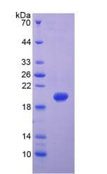 Human MMP9 / Gelatinase B Protein (Recombinant His-T7)