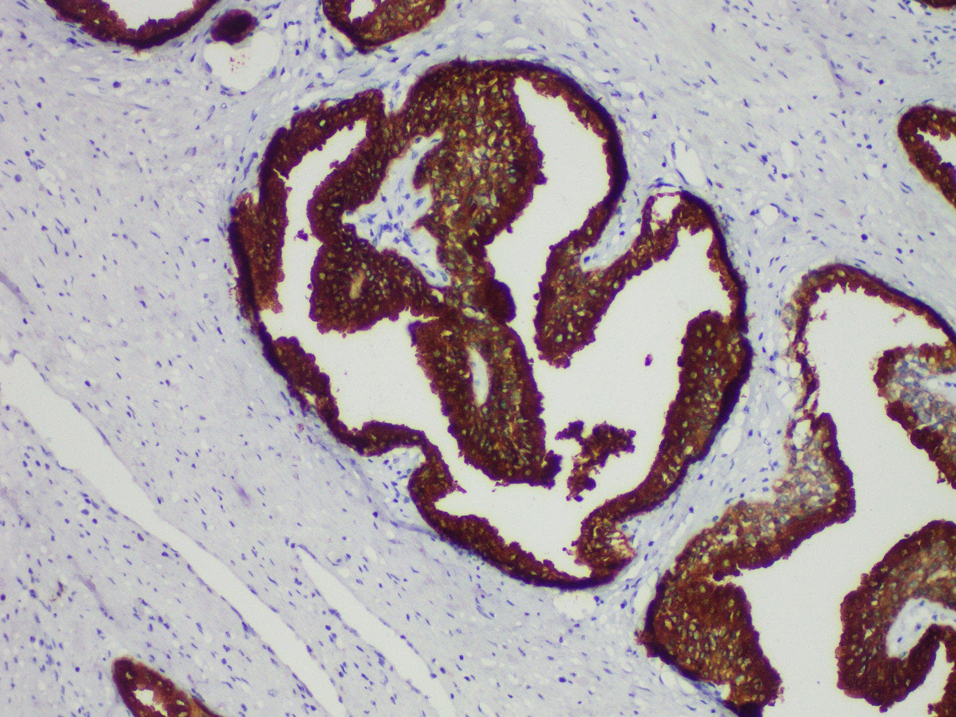 KLK3 / PSA Antibody