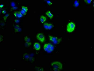 Polyclonal Rabbit anti-Human CAPN1 / Calpain 1 Antibody (aa1-714)