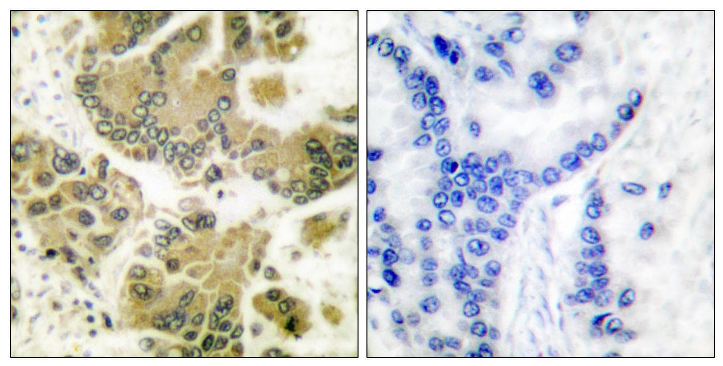 SGK1 / SGK Antibody (p422)