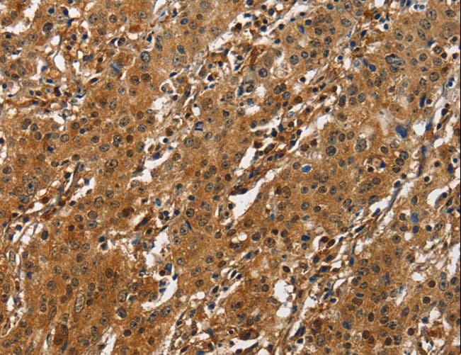 Polyclonal Rabbit anti-Human ATF4 Antibody (IHC)
