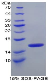 Human ITIH4 Protein (Recombinant His)