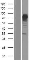 ALOX15B / 15-LOX-2 Protein (Over-Expression Lysate Myc-DDK (Flag))