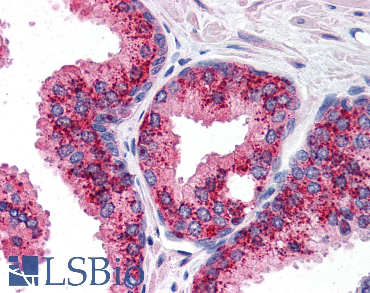 IHC-plus™ BIRC2 / cIAP1 Antibody