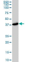 Monoclonal Mouse anti-Human PSMD7 / MOV34 Antibody (clone 2G5, WB)