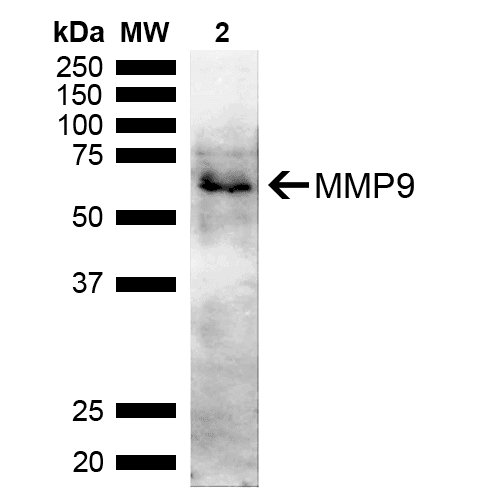 MMP9 / Gelatinase B Antibody