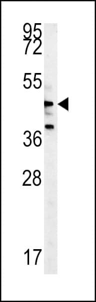 NLK Antibody (aa275-300)