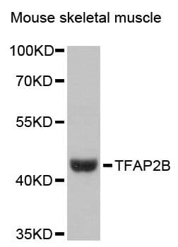 Polyclonal Rabbit anti-Human TFAP2B / AP2 Beta Antibody (WB)
